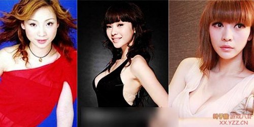 娱乐圈女明星大饼脸惊变锥子